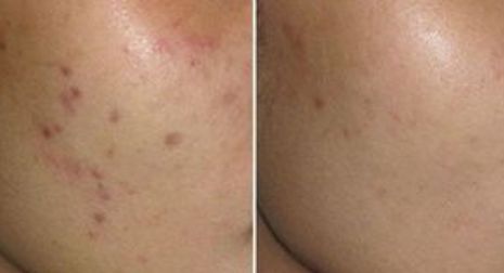 成都星范醫(yī)療美容整形醫(yī)院的醫(yī)生口碑如何？