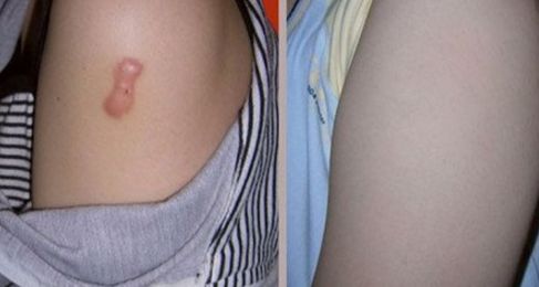 長沙整形哪家美容醫(yī)院好？專家揭秘長沙市頂級整形醫(yī)院排行榜！