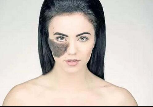 北京比較好的整容醫(yī)院楊欣的吸脂減肥技術(shù)效果如何？