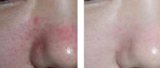 南京整鼻哪家醫(yī)院口碑好？