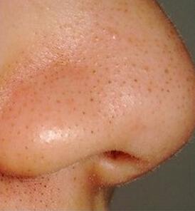 2023重慶填充動(dòng)態(tài)細(xì)紋凹陷排行top10強(qiáng)的醫(yī)生(鄧穎&nbsp;、張代祿、田凱私立醫(yī)美有看頭)