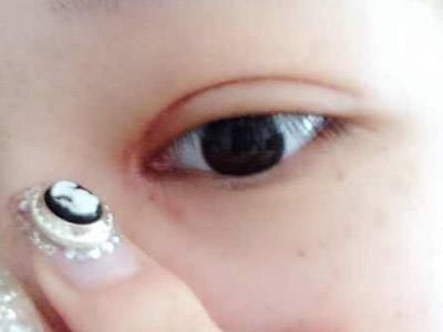 2023鄭州假體隆胸自體脂肪正規(guī)專家排名十強(屈秋芳、孫玉峰、宋賢磊實力口碑沒一個差的)