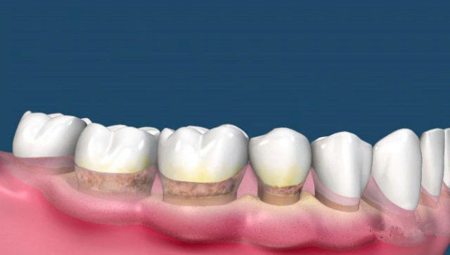 2023東莞瘦腹權(quán)威專家排名榜前10強(林凡凡、宋亞、黃尾全具備資質(zhì)和實力)