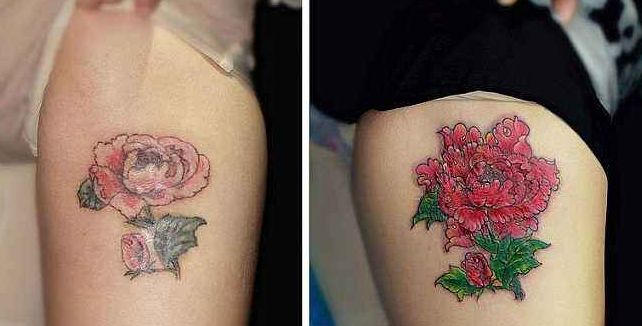 杭州填淚溝哪家醫(yī)院好？專家推薦的最佳醫(yī)療機(jī)構(gòu)