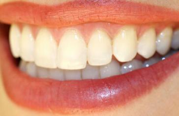 2023蘭州超聲刀去眼皺紋上榜清單前10強(qiáng)醫(yī)生(蘆蔓莉、蘇子平、加曉東優(yōu)點(diǎn)很明顯)