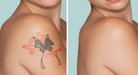 昆明燒傷疤痕消除專(zhuān)家推薦：百家醫(yī)院評(píng)選全指南