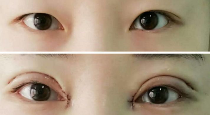 貴陽哪家醫(yī)院熱瑪吉效果好，值得推薦？