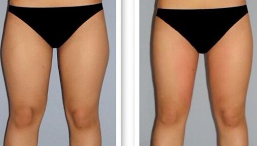 杭州疤痕醫(yī)院排名哪家好？揭秘杭州頂級(jí)疤痕醫(yī)院榜單！