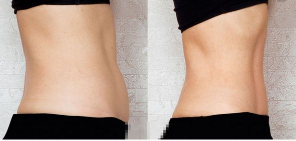 上海祛斑術(shù)哪家醫(yī)院好？解讀上海祛斑術(shù)醫(yī)院排名和專(zhuān)家推薦