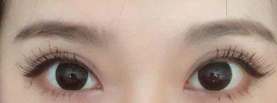 西安哪家醫(yī)院的激光祛痘項(xiàng)目質(zhì)量好？