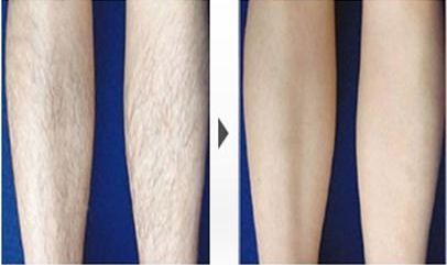 哈爾濱哪家醫(yī)院祛斑好？-排名第一的專業(yè)醫(yī)院，讓您擁有無瑕疵肌膚！