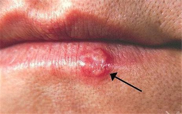 2023婁底熱瑪吉祛額頭紋排名前十醫(yī)生(邱敏、潘葵、蔣松林預(yù)約掛號攻略)