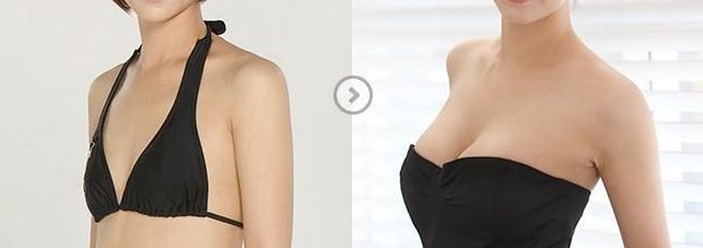 鄭州瘦臉針效果如何？一起探討哪家醫(yī)院好！