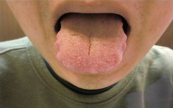 2023西寧下頜角修復(fù)正規(guī)專家口碑十強(qiáng)(韓玲、吳漢強(qiáng)、焦志云鎖定榜前三！)