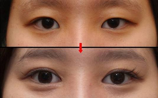 2023昆明微雕去眼周紋口碑10強(qiáng)專(zhuān)家(李元駿、馬志丹、劉小星口碑實(shí)力認(rèn)證)