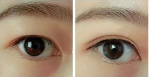 合肥熱瑪吉哪家醫(yī)院好？優(yōu)質服務與專業(yè)技術讓您擁有完美體驗。