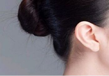 北京熙朵醫(yī)療美容門診部的技術(shù)口碑好不好？費用如何？