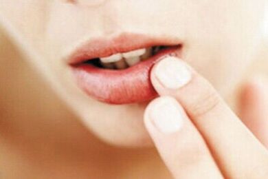 2023濟(jì)南激光祛眼睛細(xì)紋醫(yī)生前10強(qiáng)排名榜(李文德、王曉林、趙峰值得信賴和選擇！)