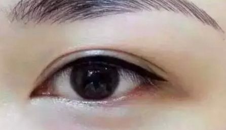 青海大學(xué)附屬醫(yī)院醫(yī)療整形美容科是否專業(yè)可靠？優(yōu)勢有哪些？