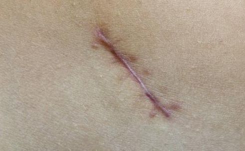 重慶整形技術(shù)，哪家醫(yī)院好？探尋重慶整形技術(shù)最佳醫(yī)院有哪些