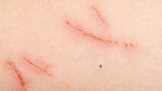 開封哪家醫(yī)院的減肥治療效果最好？