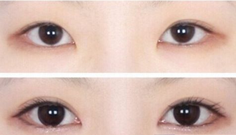 濟(jì)南哪家醫(yī)院的豐胸手術(shù)效果最好？