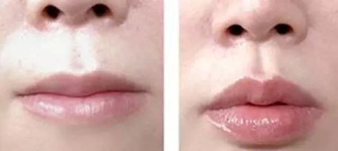 2023南寧乳房縮小醫(yī)生口碑10強(qiáng)(李科、唐超、龔筱嵐專家呼聲很高)