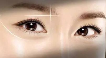 2023南京小切口去除印第安紋專家口碑榜前10強(王珣、汪樹杰、劉明星TOP榜實力全城俱佳)