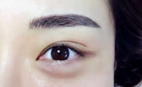 吉安哪家整形醫(yī)院的美容效果好？