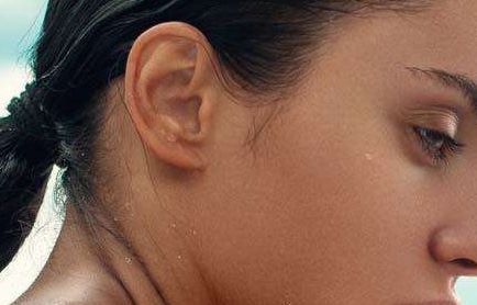 福州胎記專科醫(yī)院哪家好？解析福州市胎記治療醫(yī)院排名