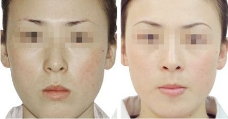 紹興市整形醫(yī)院排名及口碑評價：哪家紹興醫(yī)療整形醫(yī)院好