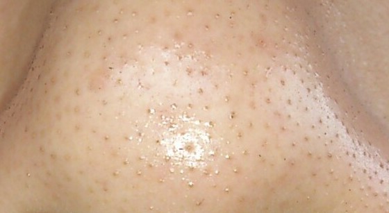 2023承德自體脂肪填充塑型前十名的專家(魏國祥、王紅、韓永剛都是高人氣專家！)