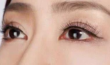 2023西安伊婉玻尿酸填充淚溝專家在榜名單TOP10(周凱、王艷娜、樸俊做過說恢復(fù)期短！)