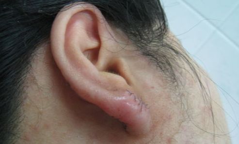 南京下頜骨整形醫(yī)院排名及口碑如何？