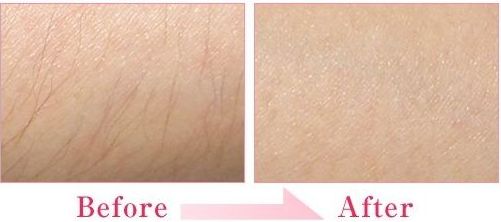 廣東珠海科美醫(yī)療美容醫(yī)院怎么樣？廣東珠?？泼泪t(yī)療美容醫(yī)院簡介|醫(yī)生團(tuán)隊|口碑評價！