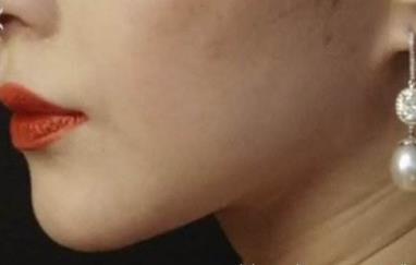 2023深圳咬肌變小瘦臉醫(yī)生推薦前10強(qiáng)(白云、李鵬、羅文關(guān)注度不斷攀升)