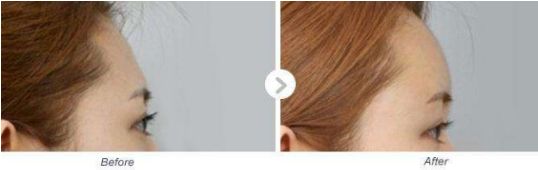 河南有哪家專業(yè)的小腿抽脂醫(yī)院值得推薦？