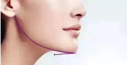 蘭州雀斑問(wèn)題煩惱？快來(lái)尋找最佳治療方法，推薦多家正規(guī)醫(yī)院！