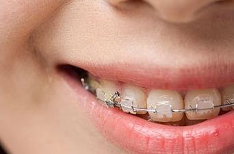 2023濟寧面部皺紋除皺針權(quán)威醫(yī)生榜單前10位(李春燕、朱汝崗、劉郭專注技術(shù)提升)