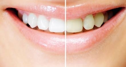 南方醫(yī)院董自清做面部脂肪填充效果如何？樸素自然且光滑無(wú)痕，沒(méi)有坑洼效應(yīng)嗎？