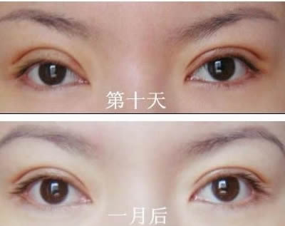 2023洛陽(yáng)額頭打除皺針在榜單前十位醫(yī)生(劉戰(zhàn)輝、黃浩浩、周先華手法嫻熟自然)