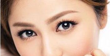 深圳薇姿整形醫(yī)院的雙眼皮手術(shù)效果怎么樣？