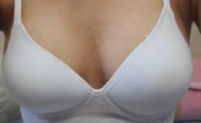 2023杭州晶塑去痘坑推薦10強醫(yī)生(王新宇、閉陸祥、羅麗娟各個風采展現(xiàn))