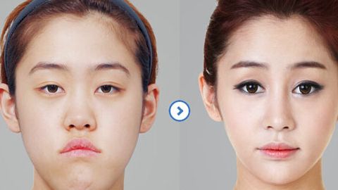 北京大學(xué)國際醫(yī)院整形外科醫(yī)生口碑如何？整形費用合理嗎？