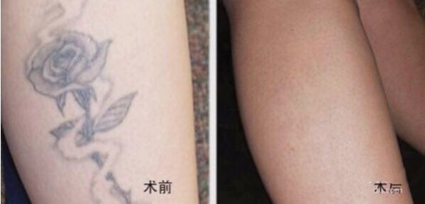 不二選擇！上海鼻修復(fù)專家徐永豐、劉仁輝搶占熱門名單成功！個人實力攀升不可阻擋！