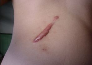 南寧激光美容中心哪家好？探索最佳的南寧激光美容中心排名及用戶口碑