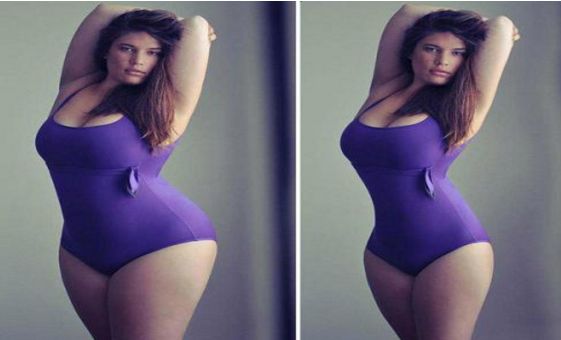 沈陽哪家醫(yī)院割雙眼皮效果好，推薦2023年最受歡迎的醫(yī)院