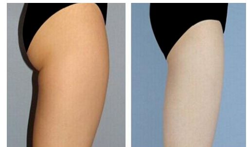 烏魯木齊超聲刀哪家好？烏魯木齊超聲刀醫(yī)院排名及專家推薦