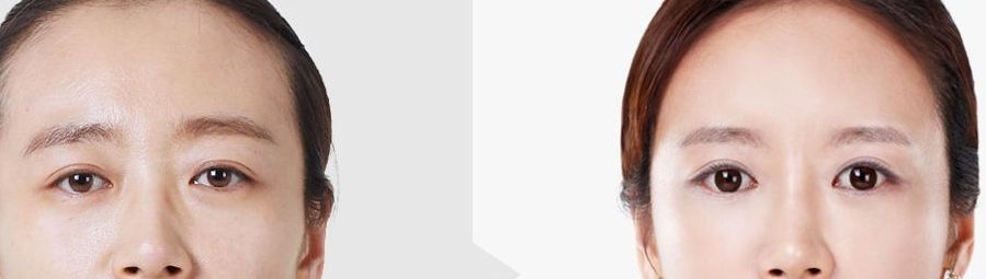 昆明祛疤醫(yī)院哪家好，正規(guī)機(jī)構(gòu)推薦