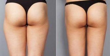 深圳面部填充醫(yī)院排名與選擇，哪家好？